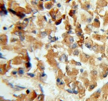 CPE Rabbit Polyclonal Antibody