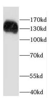 CARD11 Rabbit Polyclonal Antibody