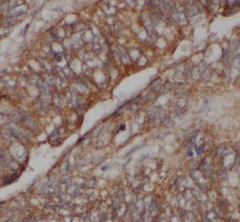 CARD11 Rabbit Polyclonal Antibody