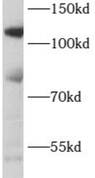 CARD14 Rabbit Polyclonal Antibody