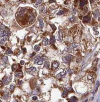 CARD8 Rabbit Polyclonal Antibody