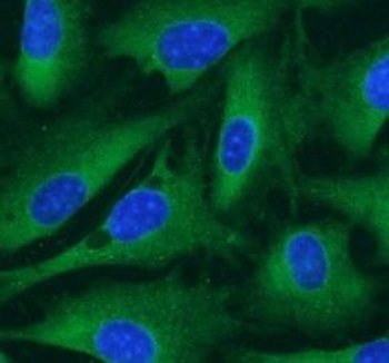 CARM1 Rabbit Polyclonal Antibody