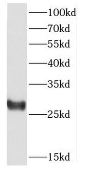 CSNK2B Rabbit Polyclonal Antibody