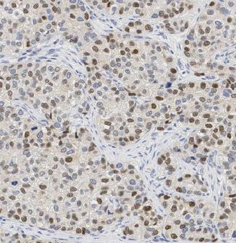 CSNK2B Rabbit Polyclonal Antibody
