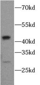 CASP1 Rabbit Polyclonal Antibody