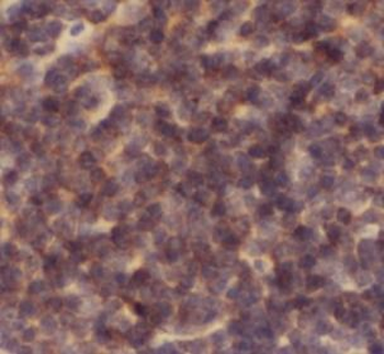 CASP1 Rabbit Polyclonal Antibody