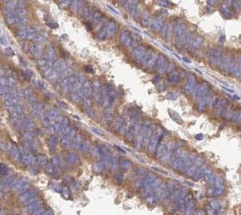 CASP10 Rabbit Polyclonal Antibody
