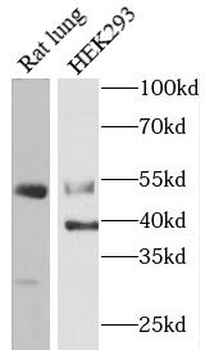 CASP12 Rabbit Polyclonal Antibody