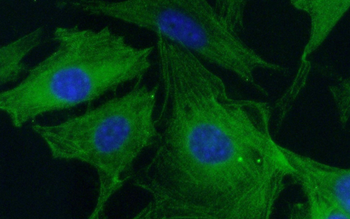 CASP3 Rabbit Polyclonal Antibody