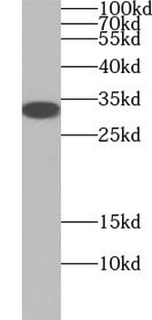 CASP3 Rabbit Polyclonal Antibody