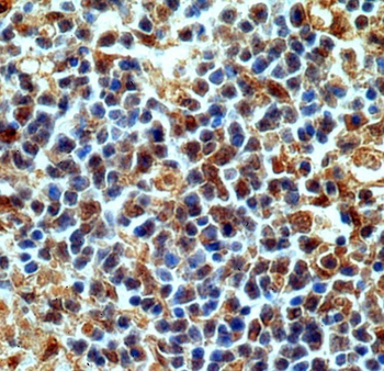 CASP3 Rabbit Polyclonal Antibody