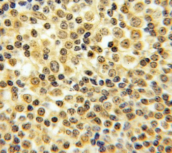 CASP8 Rabbit Polyclonal Antibody