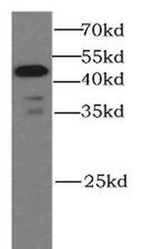 CASP9 Rabbit Polyclonal Antibody