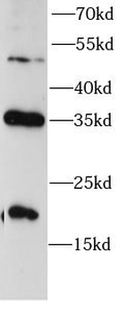 cleaved CASP9 Rabbit Polyclonal Antibody