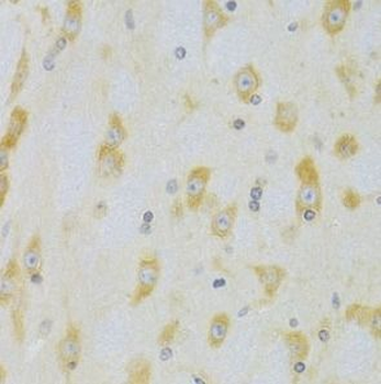 cleaved CASP9 Rabbit Polyclonal Antibody
