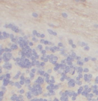 CNTNAP1 Rabbit Polyclonal Antibody