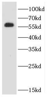 CASQ2 Rabbit Polyclonal Antibody