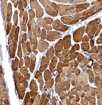 CASQ2 Rabbit Polyclonal Antibody