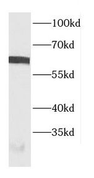 CBFA2T3 Rabbit Polyclonal Antibody