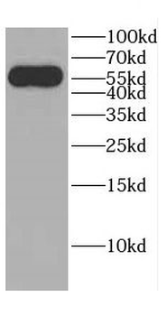 CBLL1 Rabbit Polyclonal Antibody
