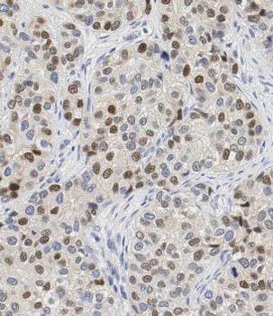 CBLL1 Rabbit Polyclonal Antibody