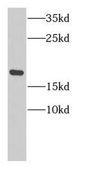 NCBP2 Rabbit Polyclonal Antibody