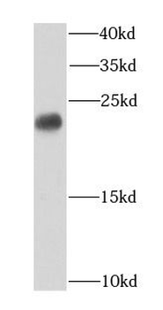 CBX3 Rabbit Polyclonal Antibody