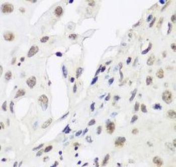 CBX3 Rabbit Polyclonal Antibody