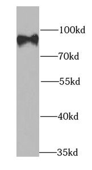 CBX4 Rabbit Polyclonal Antibody