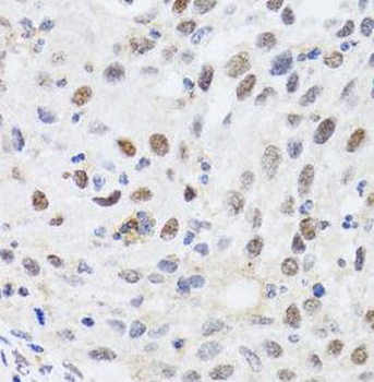 CBX4 Rabbit Polyclonal Antibody