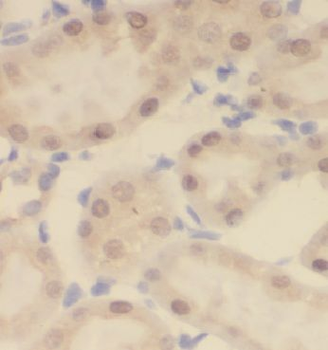 CCDC25 Rabbit Polyclonal Antibody
