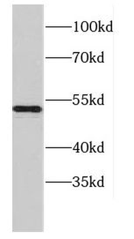 CCDC6 Rabbit Polyclonal Antibody