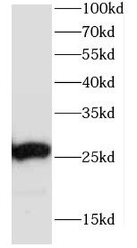 CCDC85B Rabbit Polyclonal Antibody