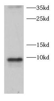 CCL28 Rabbit Polyclonal Antibody