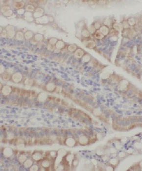 CCL28 Rabbit Polyclonal Antibody