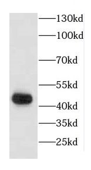 CCR5 Rabbit Polyclonal Antibody