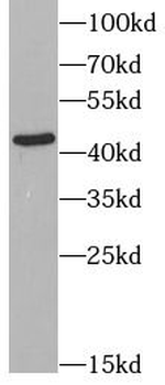 CCR7 Rabbit Polyclonal Antibody