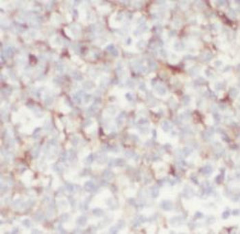 CCR7 Rabbit Polyclonal Antibody
