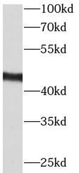 CCRL2 Rabbit Polyclonal Antibody