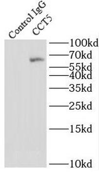 CCT5 Rabbit Polyclonal Antibody