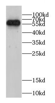 CCT5 Rabbit Polyclonal Antibody