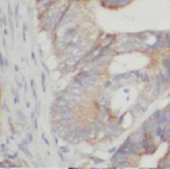CCT5 Rabbit Polyclonal Antibody