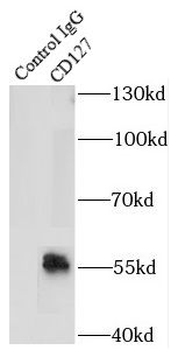 IL7R Rabbit Polyclonal Antibody