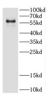 IL7R Rabbit Polyclonal Antibody