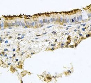 PROM1 Rabbit Polyclonal Antibody