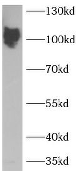 SDC1 Rabbit Polyclonal Antibody
