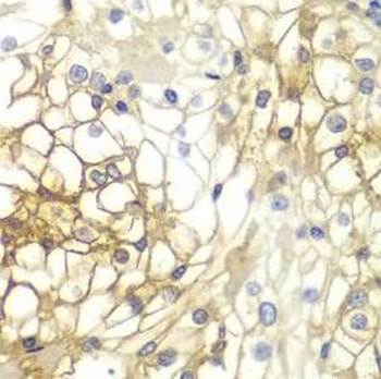 SDC1 Rabbit Polyclonal Antibody