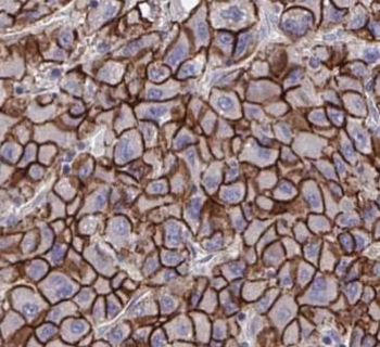 BSG Rabbit Polyclonal Antibody