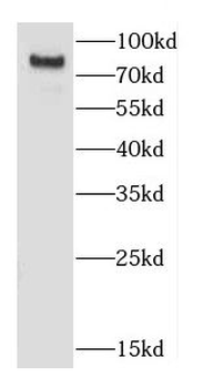 CD164 Rabbit Polyclonal Antibody