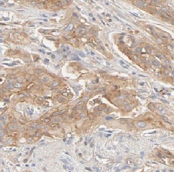 CD164 Rabbit Polyclonal Antibody